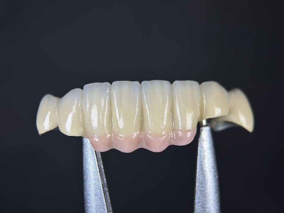 Послуги зубного техніка