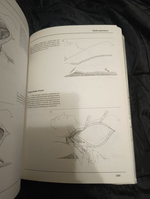 Chirurgia operacyjna tom l