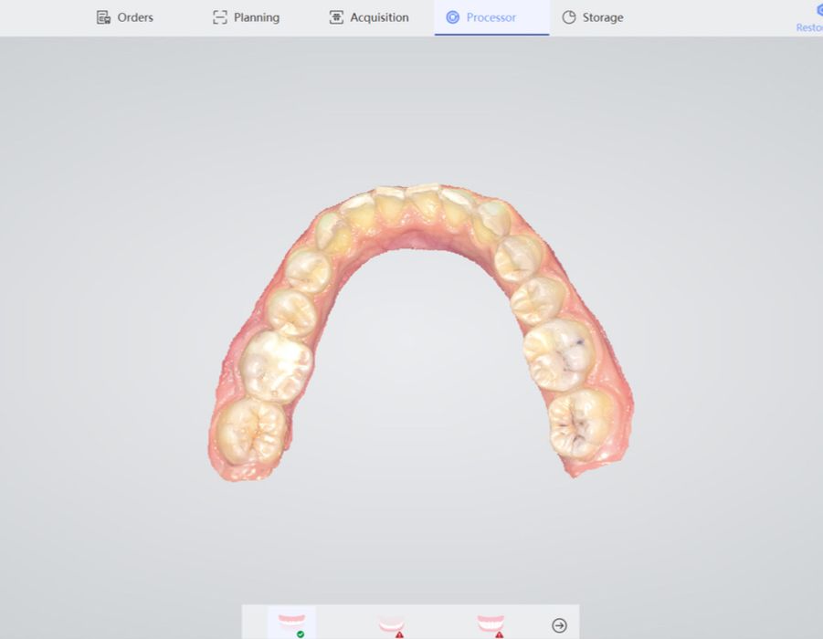 Scanner intraoral NOVO PANDA P2 Plus