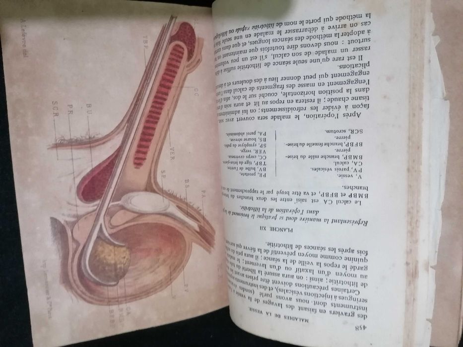 Traité Pratique des Maladies des Voies Urinaires, par Jozan Pére ,1884