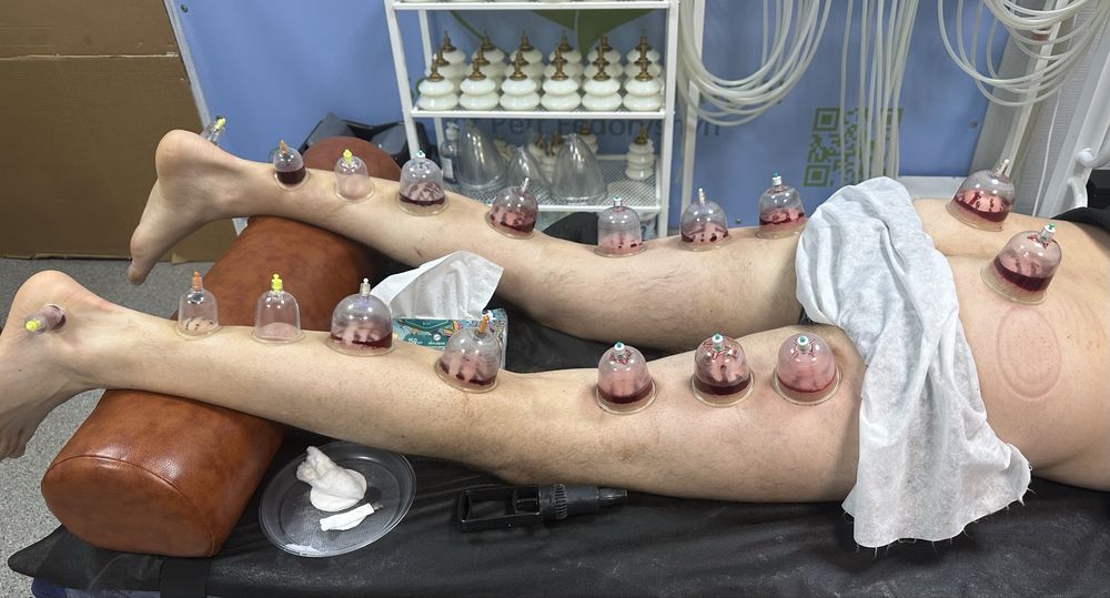 Обучение Хиджаме в Киеве. 70%  практика, постановка рук на моделях
