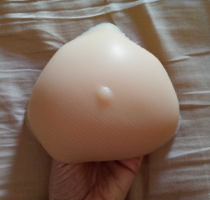 Prótese mamária da Amoena como nova