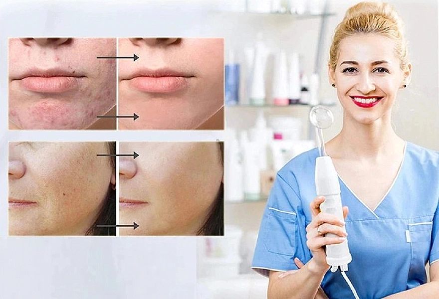 Darsonval Derma Wand 6 Elektrod Ozonoterapia Do Twarzy i Ciała
