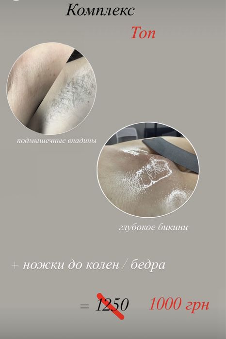 Шугаринг / Восковая депиляция / Электроэпиляция