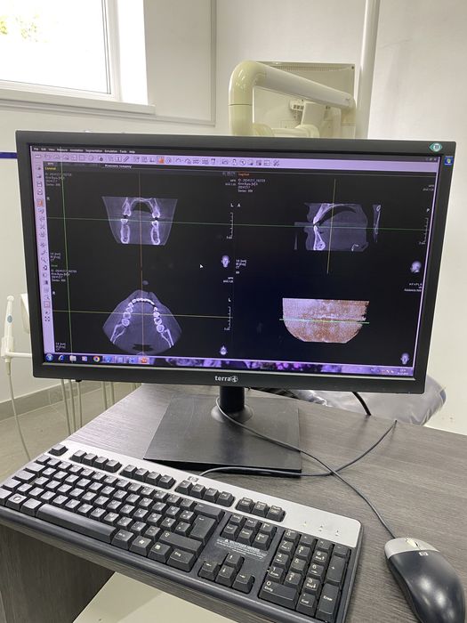 Компютерний томограф фірми  E-Woo( Vatech)
