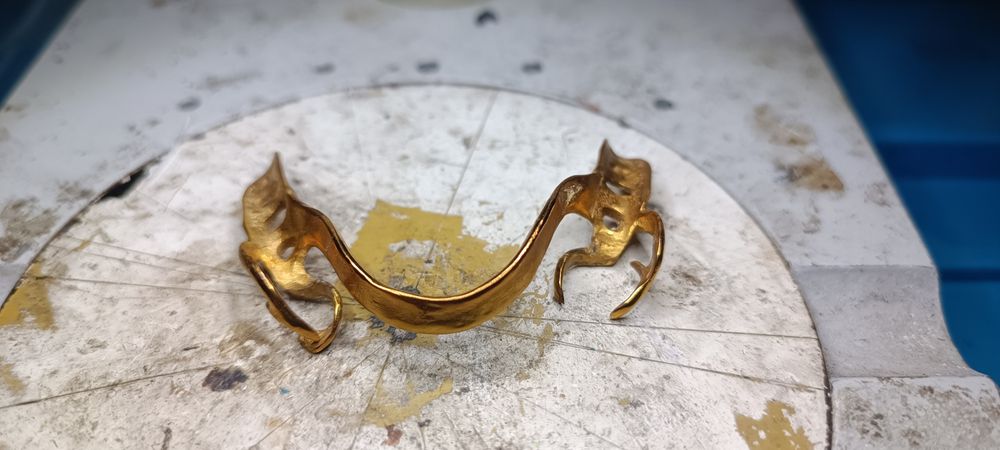 Стоматологическая позолота коронки