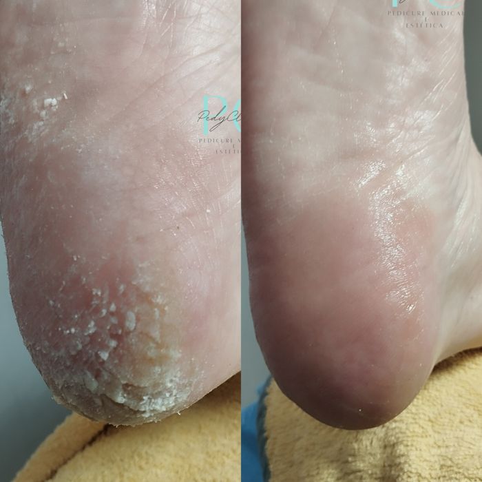 Pedy Clean, estética e cuidados específicos dos pés