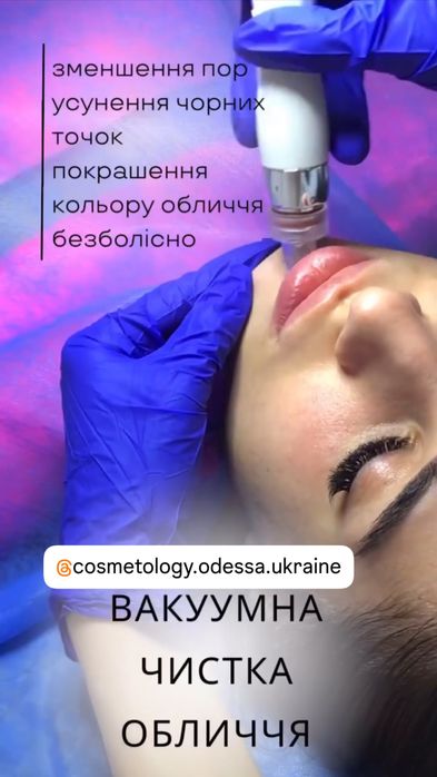 Чистка лица | |центр|