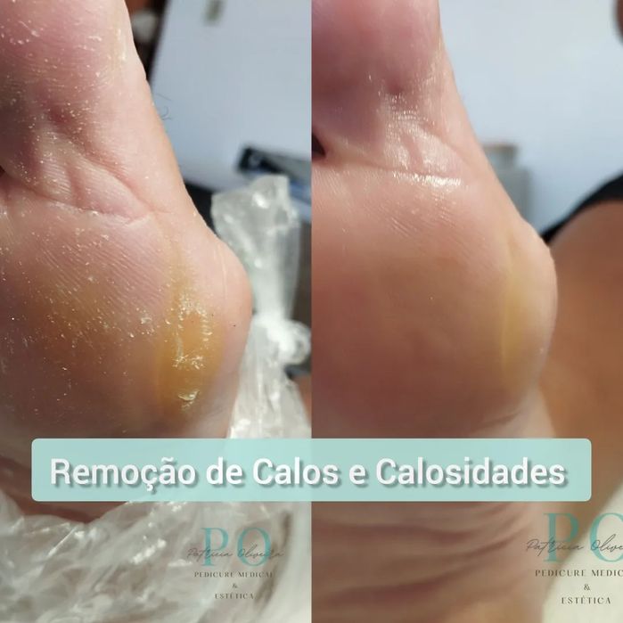 Pedy Clean, estética e cuidados específicos dos pés
