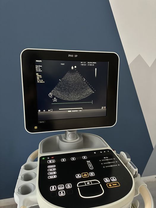 Ультразвуковий апарат Philips Sparq 2014р 3 датчика, УЗИ УЗД КАРДІО