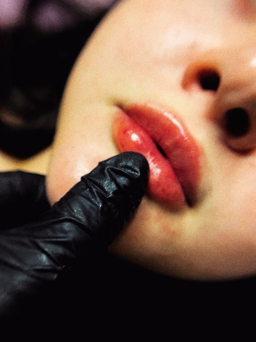 Акція! Stylage M / Контурна пластика губ /увеличение губ