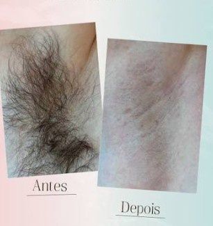 Depilação/pedicure/massagem