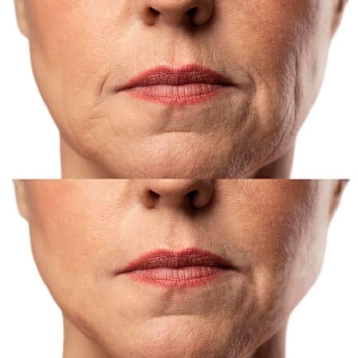 Мікрострумовий RF Lifting Масажер.  для обличчя Skin Lifting 7.новий