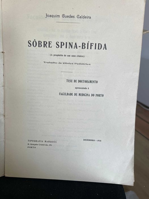 Livro "Sobre Spina Bífida"- Caldeira, Joaquim Guedes