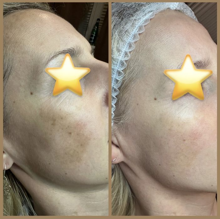 Dyskretna zmiana. Wyraźny efekt.