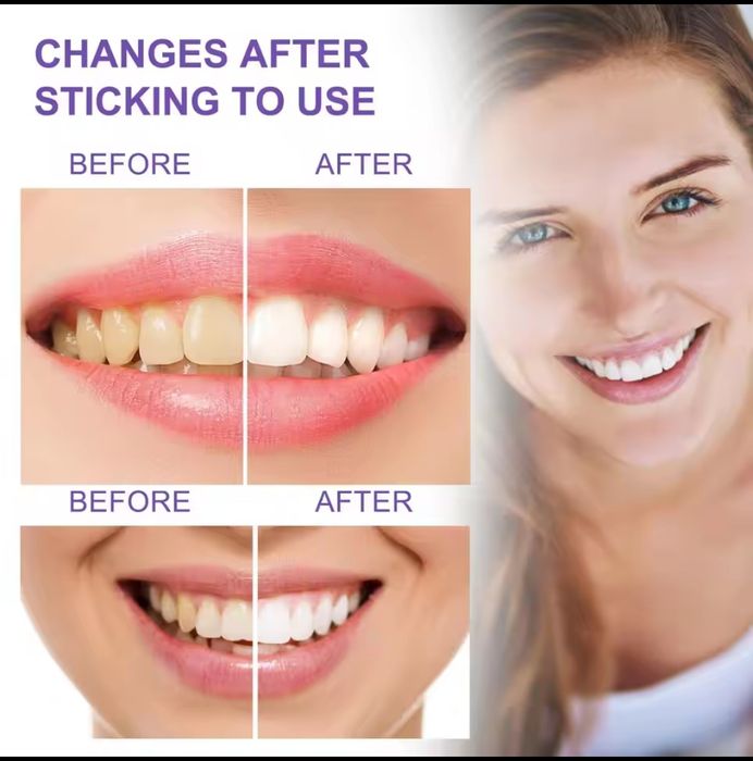 Branqueamento dental