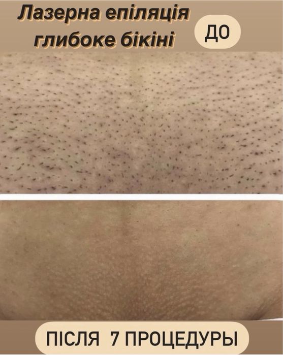 Массаж эпиляция. Только для женщин. Улица Степана Тільгы 34 А