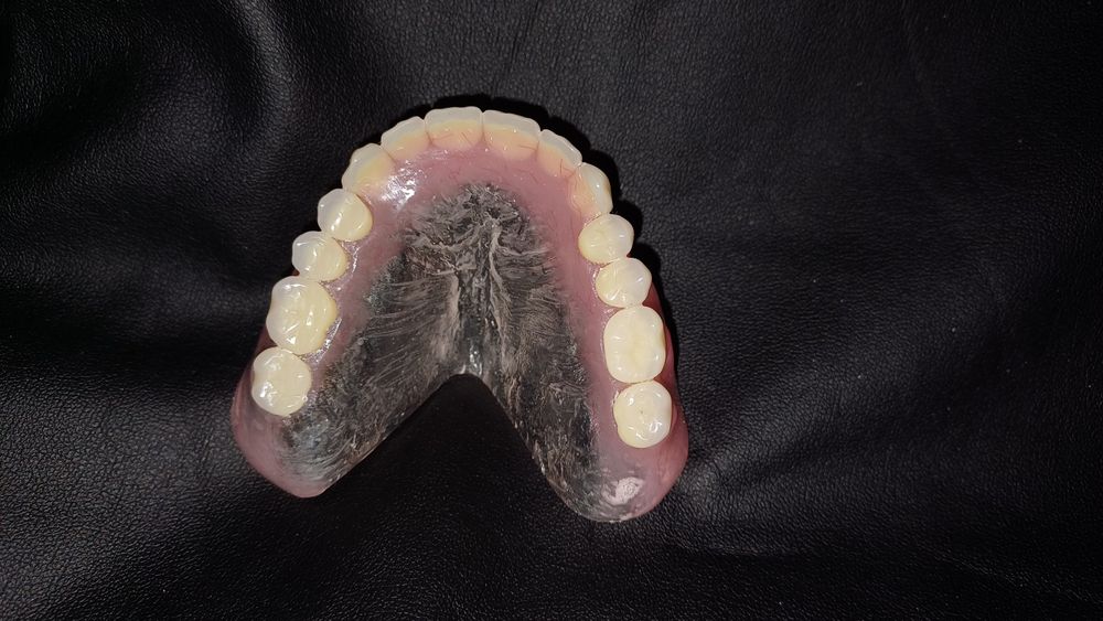 Зубний технік!Співпраця зі стоматологом