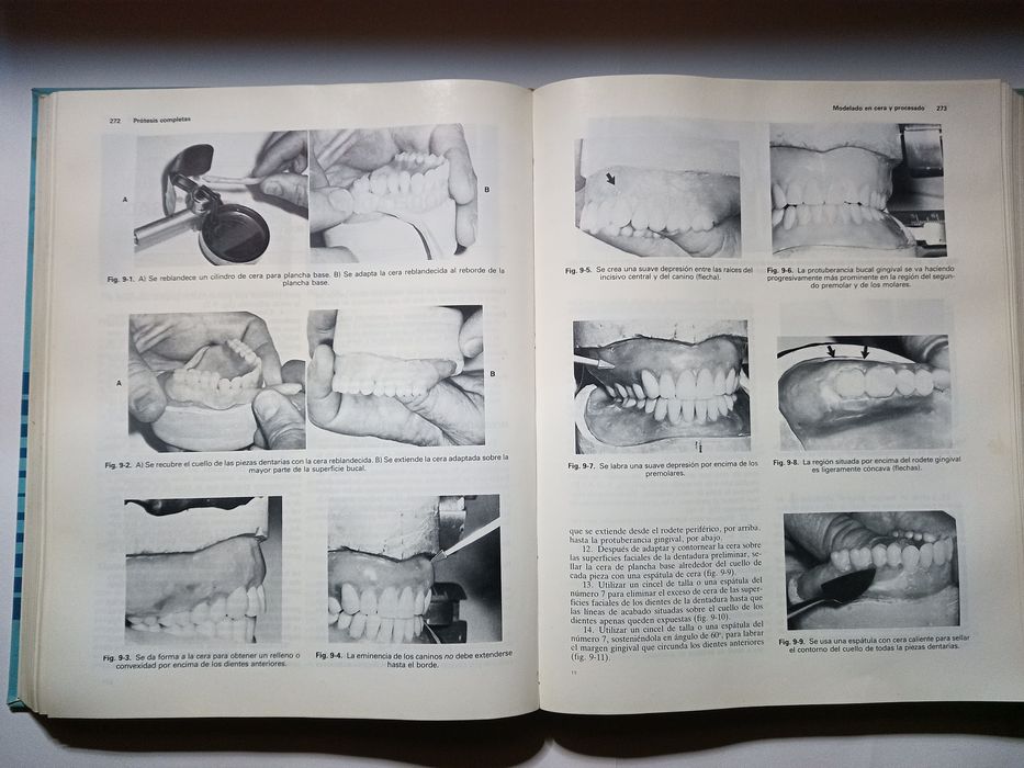 Procedimentos em laboratório de prótese dentária - livros técnicos