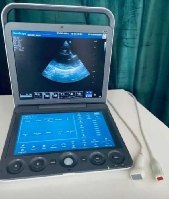 USG SonoScape S9 – 4 głowice, Doppler, kardiologia, 2018