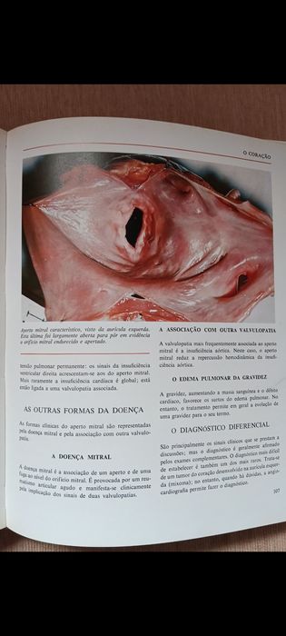 Enciclopédia Verbo "Coração/Artérias/Veias/Pulmões/Brônquios