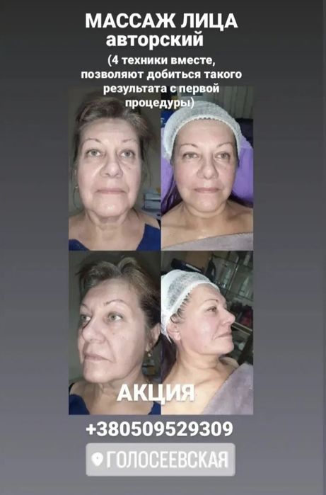 Міофасціальний,  моделюючий, лімфодренажний масаж обличчя + маска