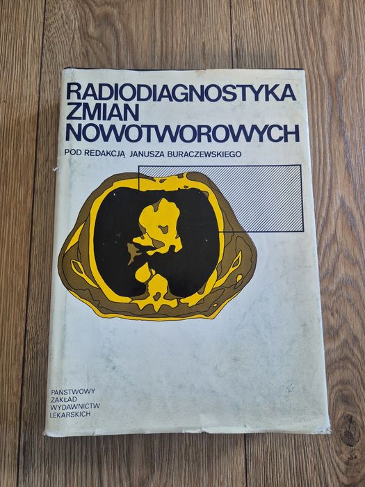 Radiodiagnostyka zmian nowotworowych