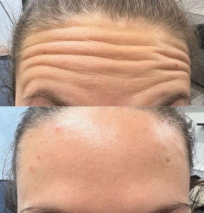 BoToX - 200 zł. za 1 okolicę, 500 zł. - 3 okolice