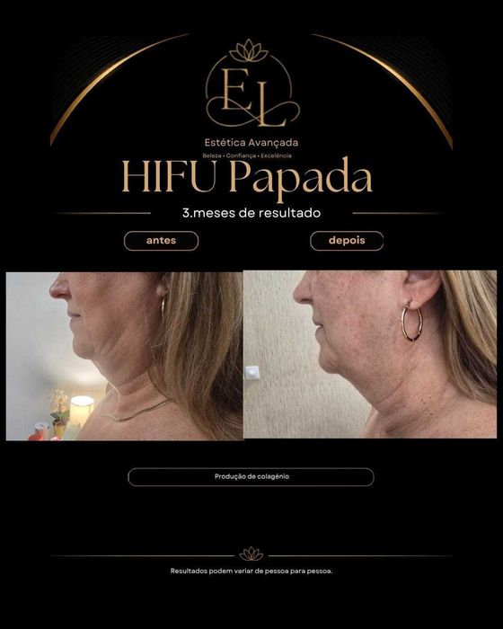Massagem Terapêutica  e Estética avançada
