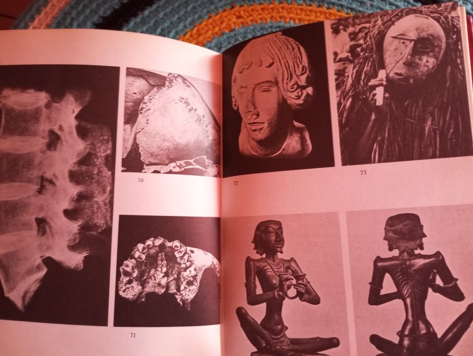 Calvin Wells - Ossos, corpos e doenças