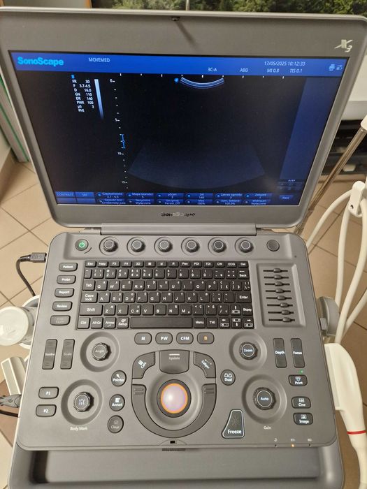 Sonoscape X3 – mobilny aparat USG klasy premium z dwiema głowicami!
