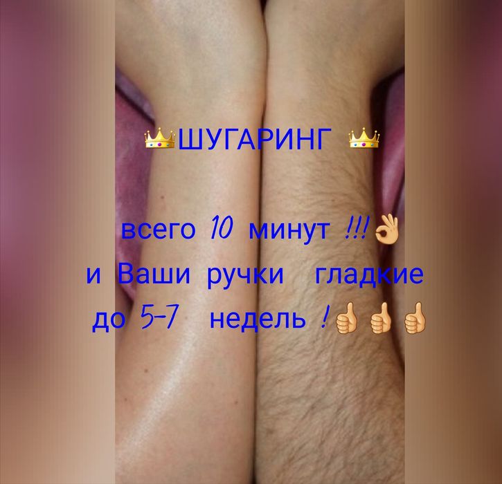 Шугаринг.  Воск. Депиляция . Лазерная  эпиляция. Дніпро, центр