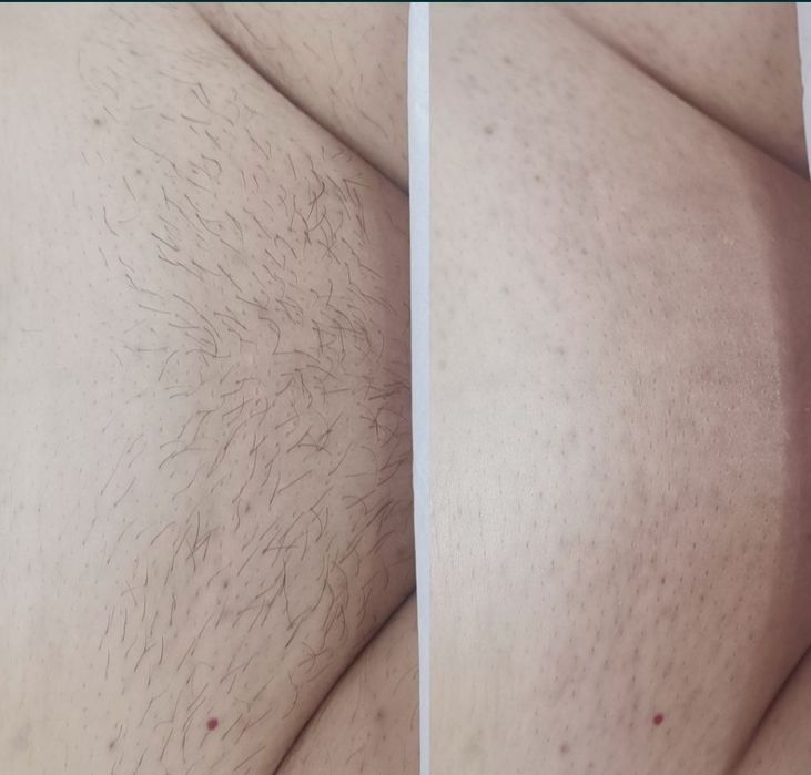 .ЖІНОЧА ВОСКОВА депіляція, Лівий берег. Чернігівська- Лісова. Працюю в