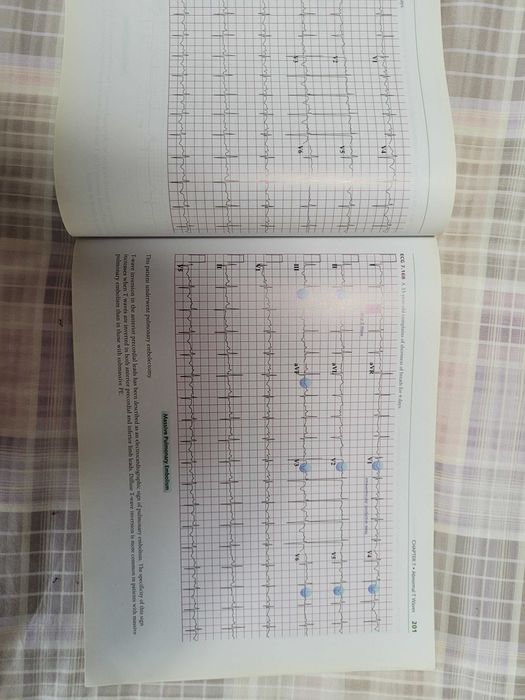 Medicina "A visual Guide to ECG interpretation" da Wolters Kluwer