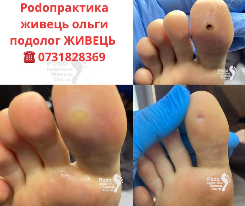 Сучасний подолог