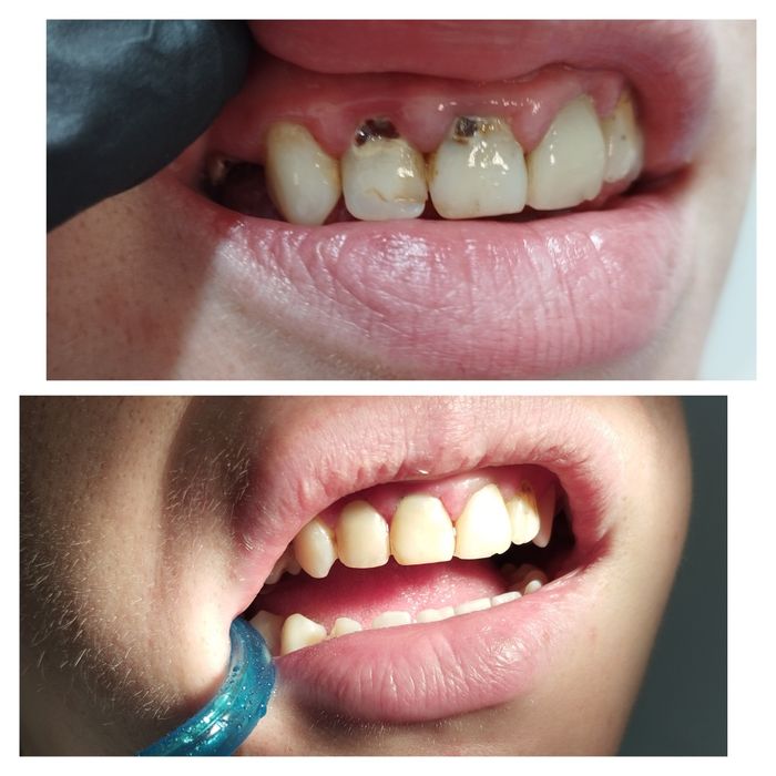 СтоматологОдесса , якісно ,безболісно, всі види стоматологічних послуг