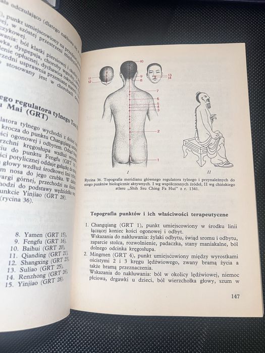 Renesans akupunktury