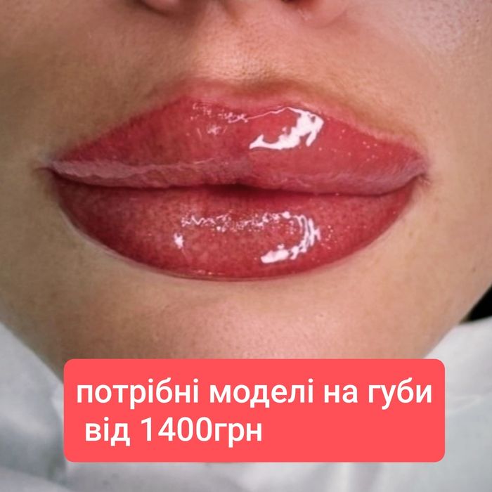 1500 грн губи контурна пластика.Ботокс.