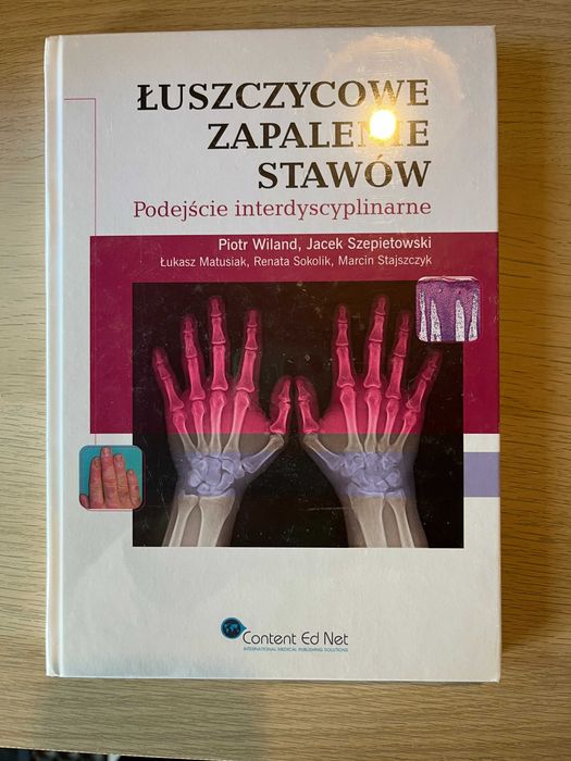 Łuszczycowe zapalnie stawów ; Wiland Szepietowski ; zafoliowane , 2012