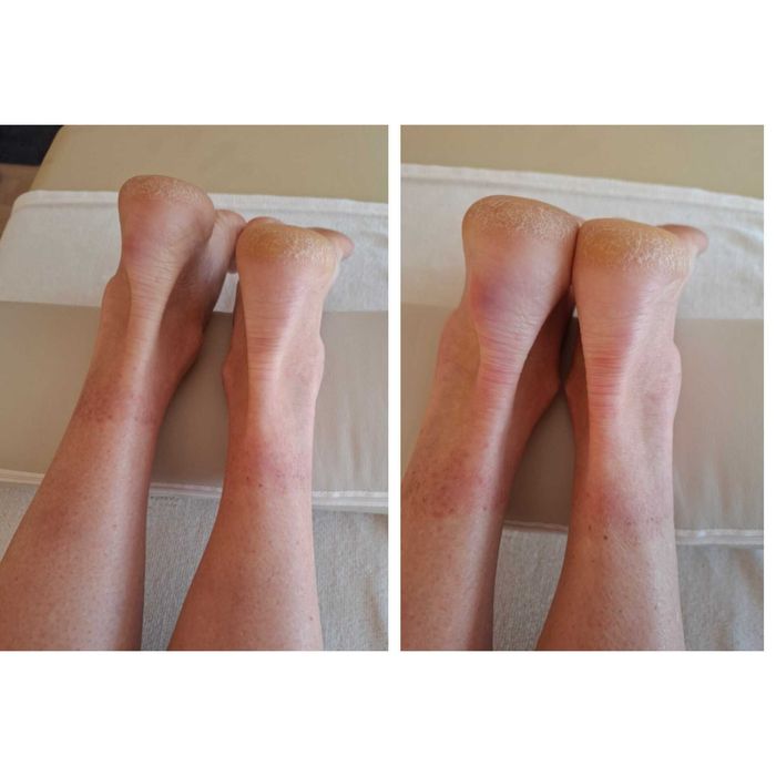 Масаж, міопресура, консультування, реабілітація. Трускавець