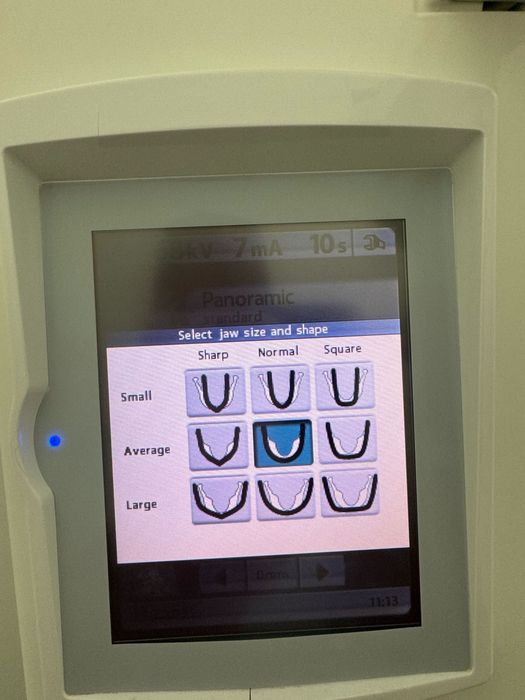 Ortopantomografo (rx panoramico)