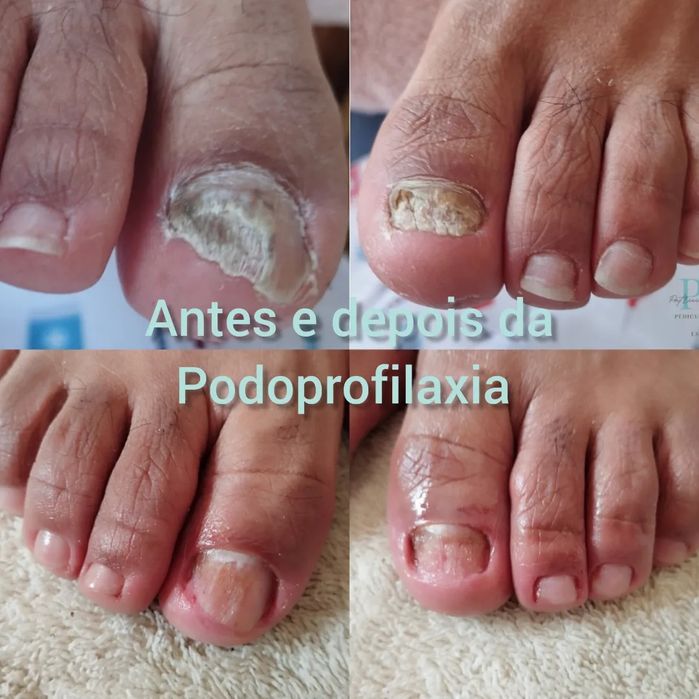 Pedy Clean, estética e cuidados específicos dos pés
