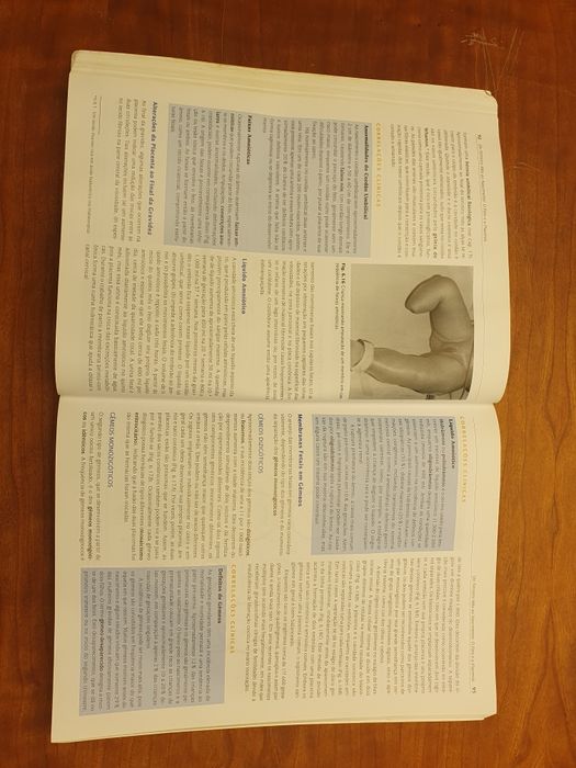 Langman Embriologia Medica
