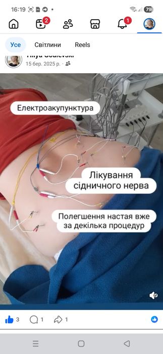 Медичний масаж | Рефлексотерапія