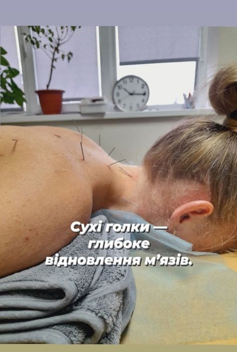 Медичний масаж | Рефлексотерапія