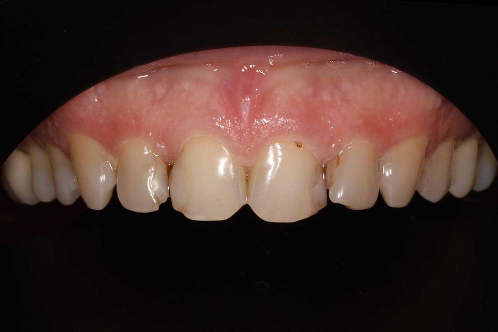 Canon EF/ Tamron 90/2.8 Di MACRO VC USD предметна стоматологія природа