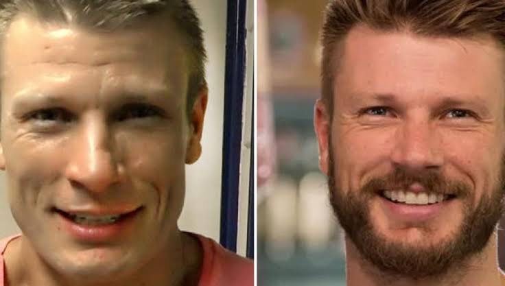 Minoxidil Extra forte -versão sem Álcool