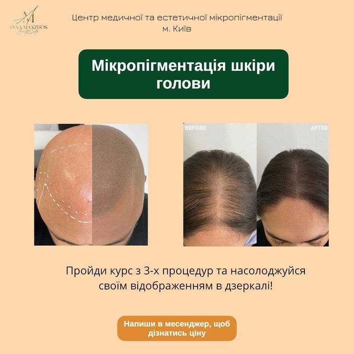 Таргетолог. SMM просування акаунтів