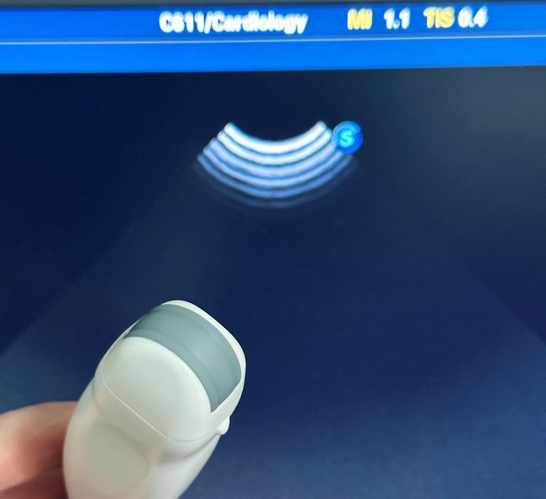 Датчик УЗИ/ УЗД SonoScape C611/ Мікро/ також 3C-A, VC6-2, 6V3, L752