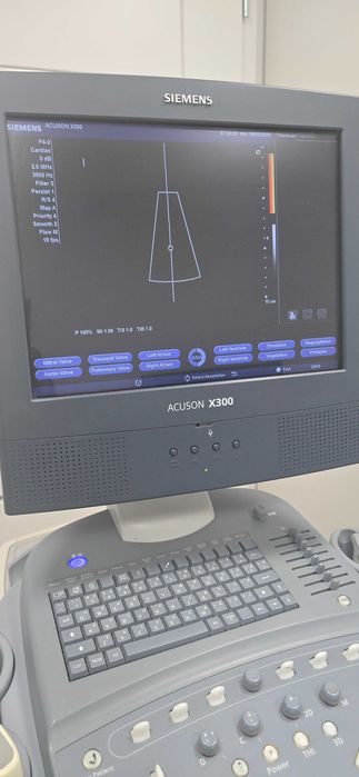 USG Siemens Acuson X300 – 4 głowice – po przeglądzie technicznym